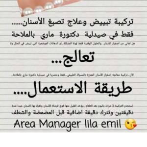 كل حاجة - تبييض الاسنان - - تركيبات د. ماري جرجس